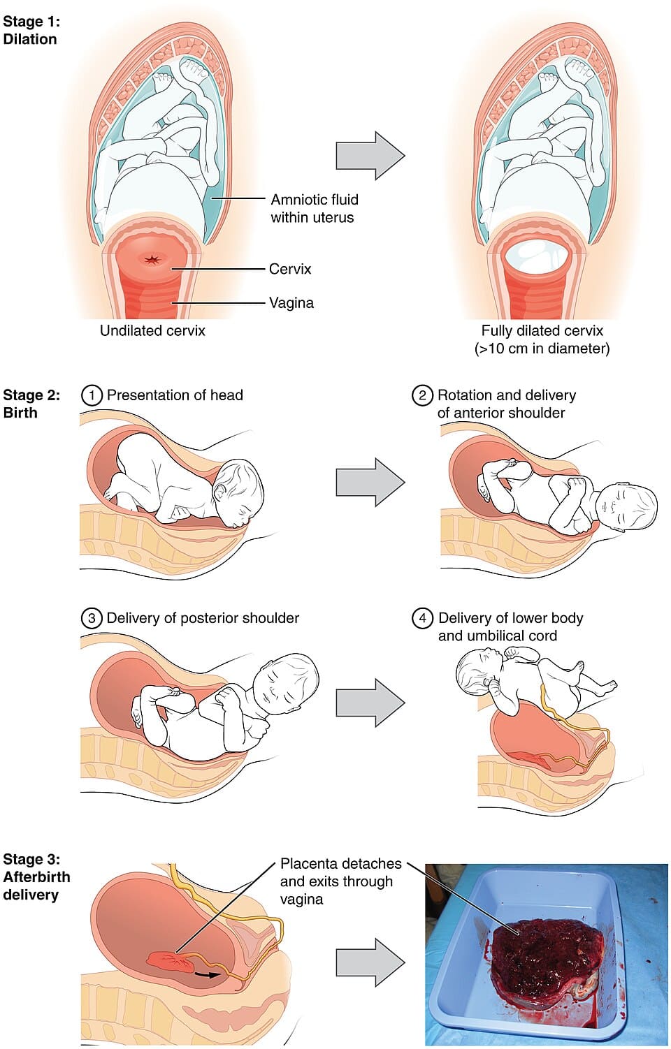 The Mechanism of Normal Labour