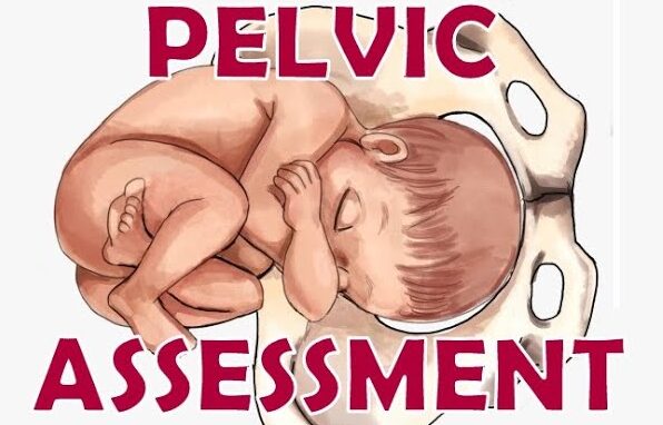 pelvic assessment