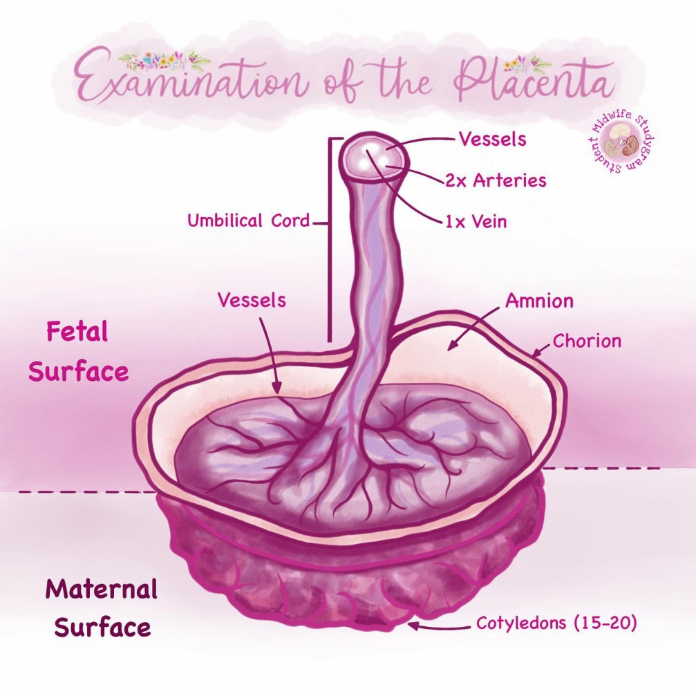 Examination of placenta