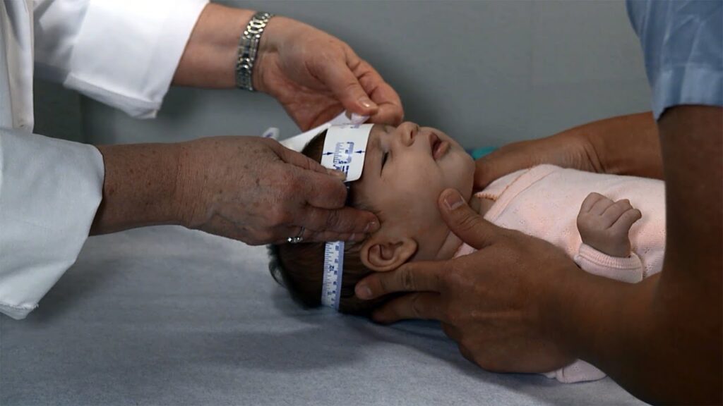 Examining the Babys Head A Clinical Procedure