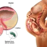 Significance of female urinary system in obstetrics