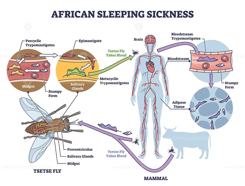 Trypanosomiasis sleeping Sickness Nurses Revision Trypanosomiasis sleeping Sickness Nurses Revision