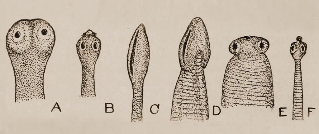 Helminthic diseases (Intestinal worms)