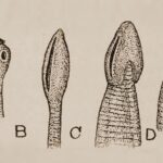 Helminthic diseases (Intestinal worms)