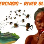 Onchocerciasis (River blindness)