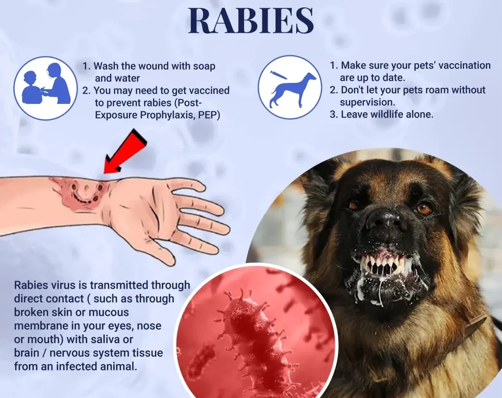 Rabies