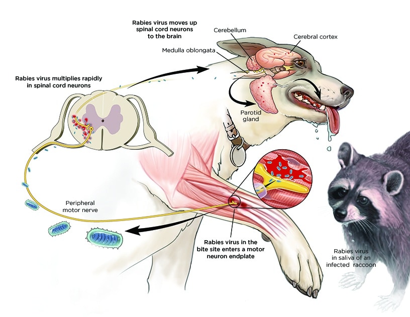 Routes of Transmission: The routes highlight the direct entry of the virus into the body: Neural route: The virus travels along peripheral nerves to the central nervous system (CNS). This is the primary route and explains the neurotropic nature of rabies. Hematogenous route (less common): The virus can enter the bloodstream and spread throughout the body, though neural spread is the predominant mechanism. Incubation Period: The incubation period varies (2 weeks to 1 year, averaging 2-342 days), depending on: Bite site: Bites closer to the CNS (head, neck) have shorter incubation periods. Tissue penetration: Deeper wounds allow for faster viral dissemination. Viral load: Higher viral loads result in shorter incubation periods. Site of the bite: Bites on the head and neck tend to have shorter incubation periods than bites on the extremities due to proximity to the brain. Pathology: Following inoculation, the virus initially replicates at the bite site for approximately 96 hours. It then spreads via peripheral nerves to the spinal cord and brain, primarily replicating in the gray matter. The virus subsequently disseminates through autonomic nerves to various organs (salivary glands, adrenal medulla, kidneys, lungs, liver, skeletal muscles, and skin). At this stage, the patient's saliva and secretions become infectious.