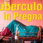 Tuberculosis in Pregnancy