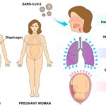 Respiratory Tract Infections in Pregnancy