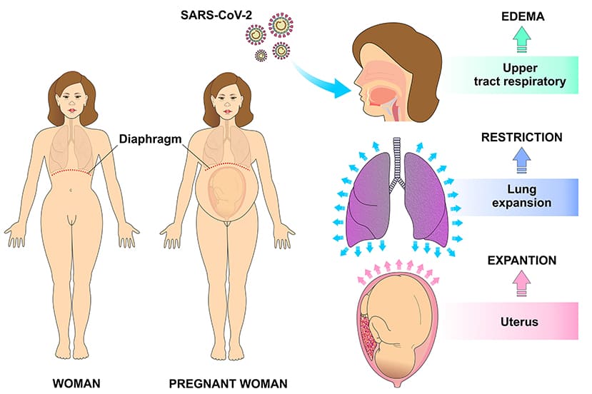 Respiratory Tract Infections in Pregnancy